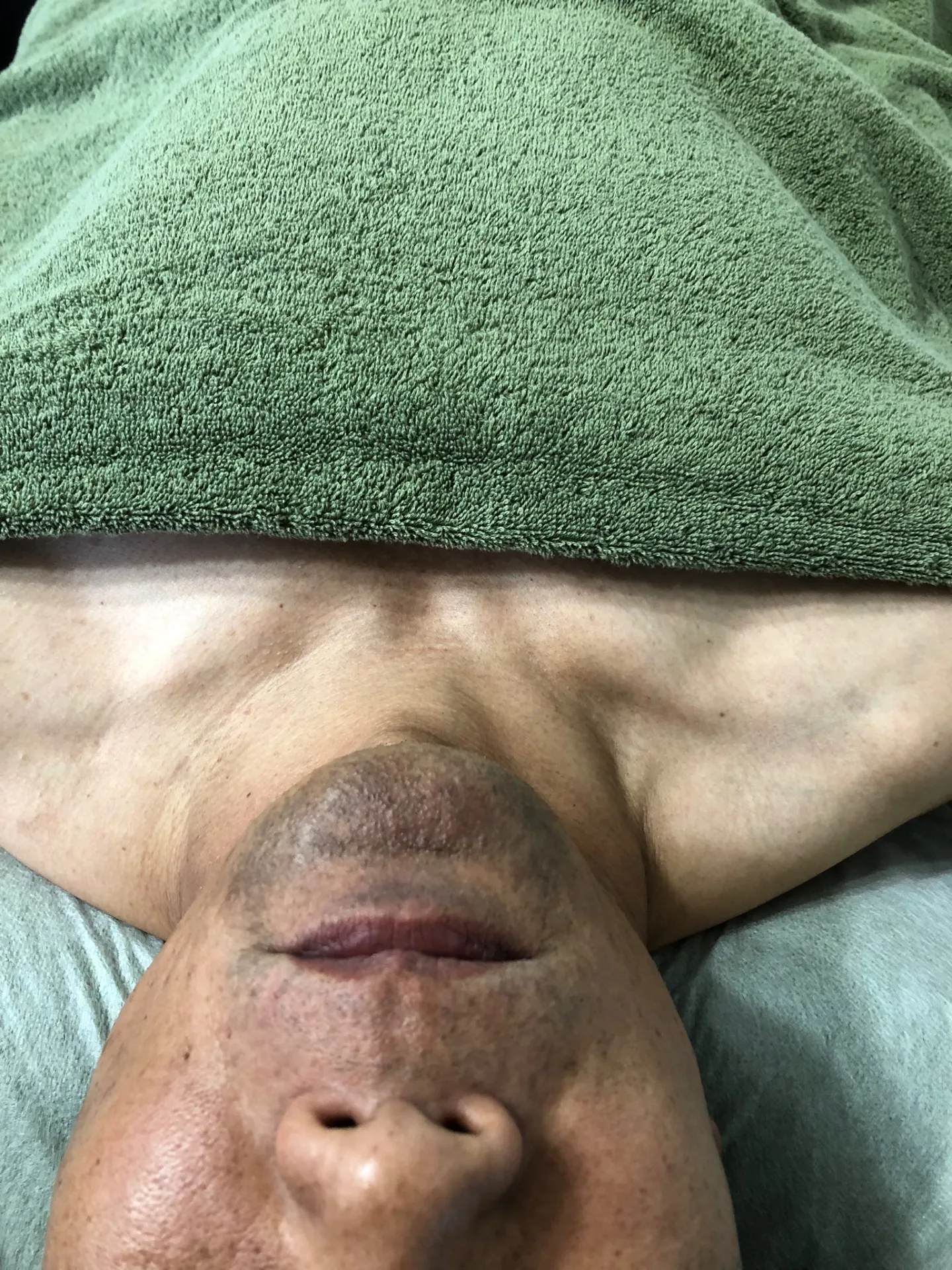 髭、腕、脚、胸 5回目